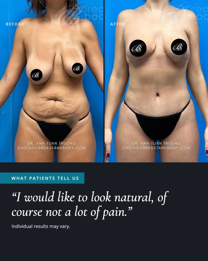 Carousel cover: before and after photos with the patient quote 'I would like to look natural, of course not a lot of pain.'